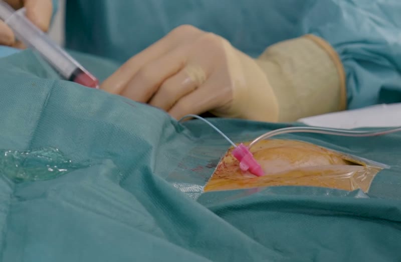 Geste de radiologie interventionnelle guidé par imagerie en temps réel